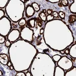 Atlas Antibodies Anti-WDR46 Antibody