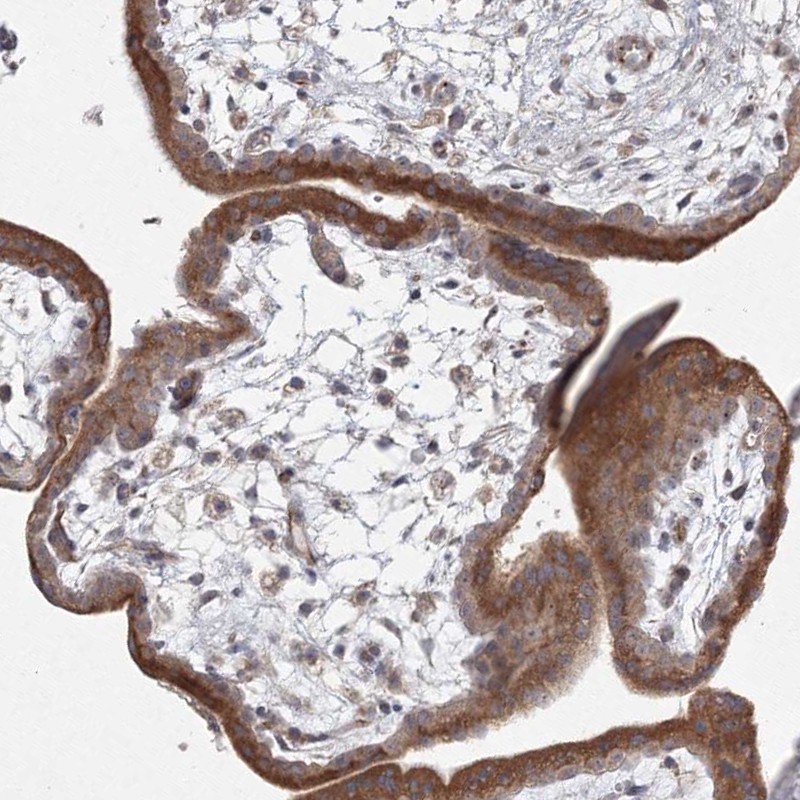 Atlas Antibodies Anti-WDR49 Antibody