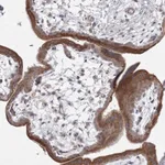 Atlas Antibodies Anti-WDR49 Antibody