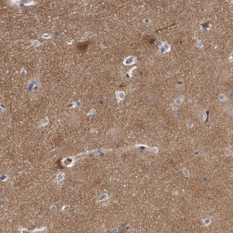 Atlas Antibodies Anti-WDR47 Antibody