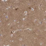 Atlas Antibodies Anti-WDR47 Antibody