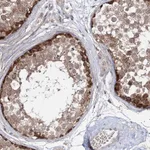 Atlas Antibodies Anti-WDR44 Antibody