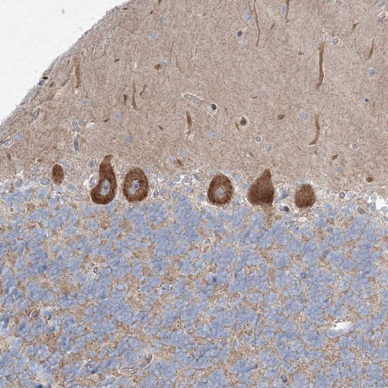 Atlas Antibodies Anti-WDR49 Antibody