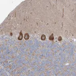 Atlas Antibodies Anti-WDR49 Antibody