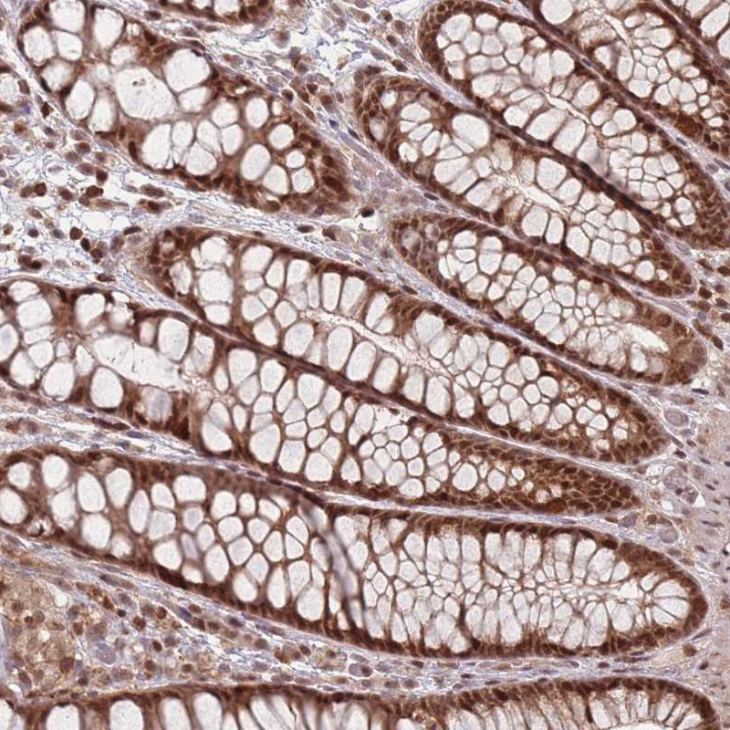Atlas Antibodies Anti-WDR55 Antibody
