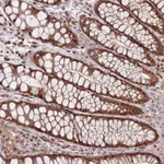Atlas Antibodies Anti-WDR55 Antibody