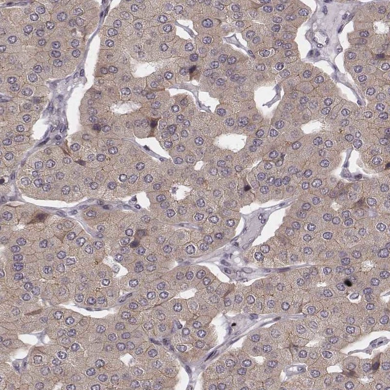 Atlas Antibodies Anti-WDR59 Antibody