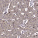 Atlas Antibodies Anti-WDR59 Antibody