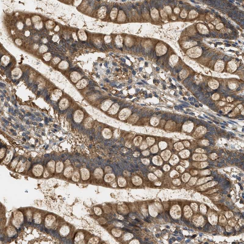 Atlas Antibodies Anti-WDR53 Antibody