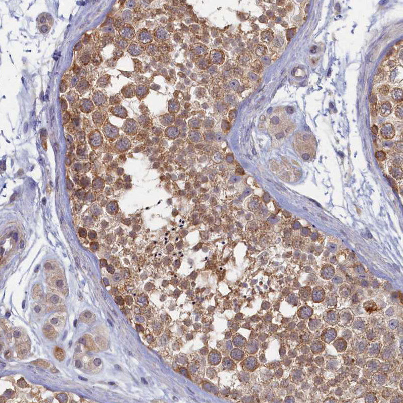 Atlas Antibodies Anti-WDR59 Antibody