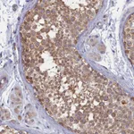 Atlas Antibodies Anti-WDR59 Antibody