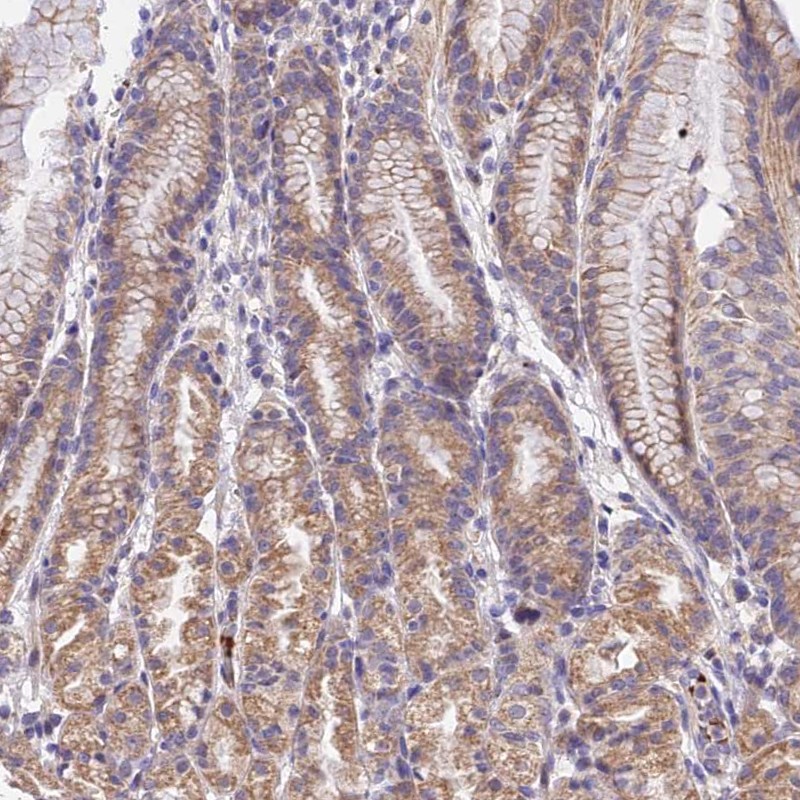 Atlas Antibodies Anti-WDR5B Antibody