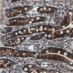 Atlas Antibodies Anti-WDR60 Antibody