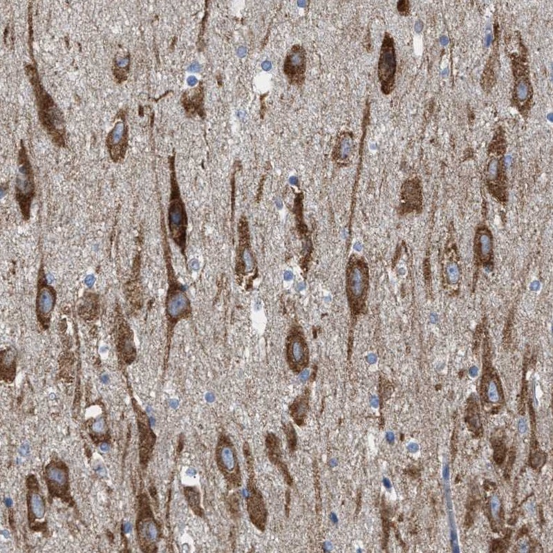 Atlas Antibodies Anti-WDR60 Antibody