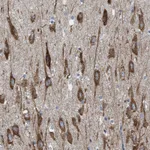 Atlas Antibodies Anti-WDR60 Antibody