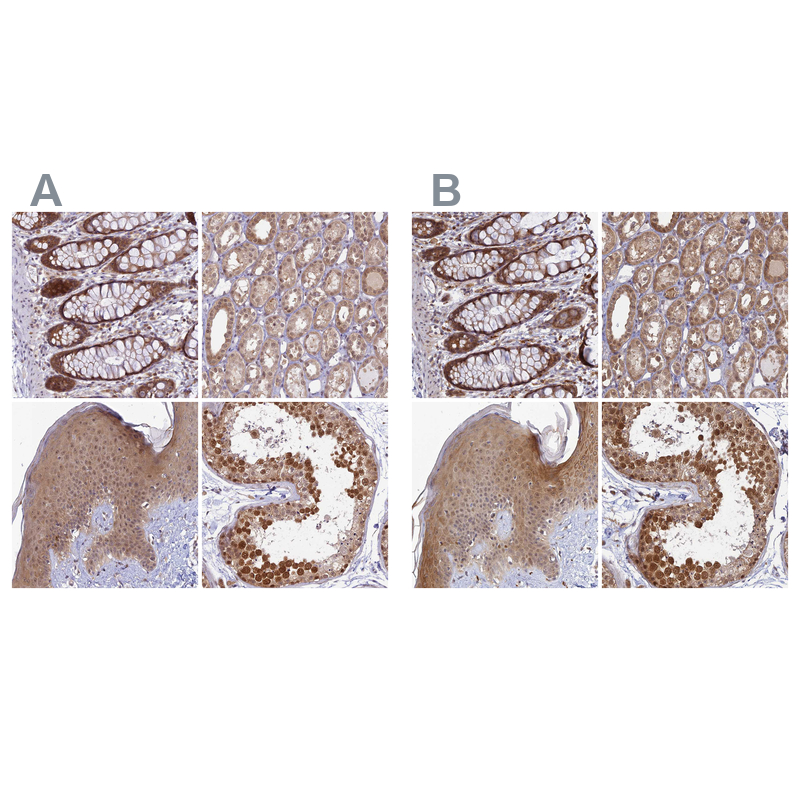Atlas Antibodies Anti-WDR61 Antibody