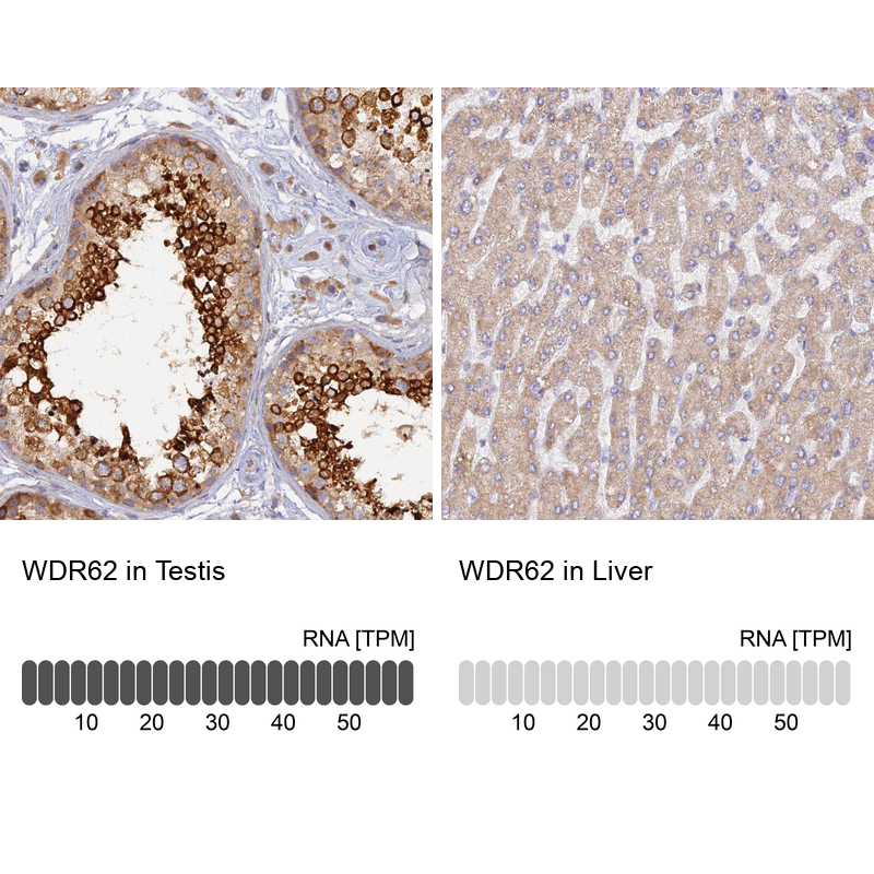 Atlas Antibodies Anti-WDR62 Antibody