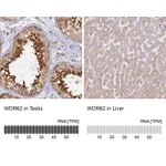 Atlas Antibodies Anti-WDR62 Antibody