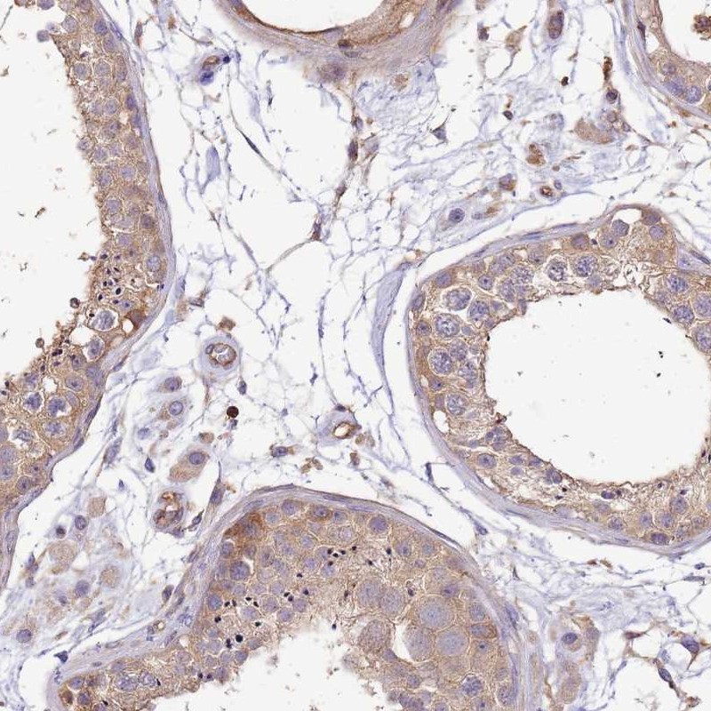 Atlas Antibodies Anti-WDR64 Antibody