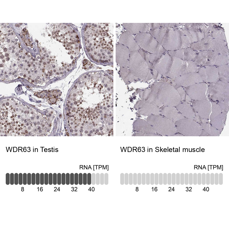 Atlas Antibodies Anti-WDR63 Antibody