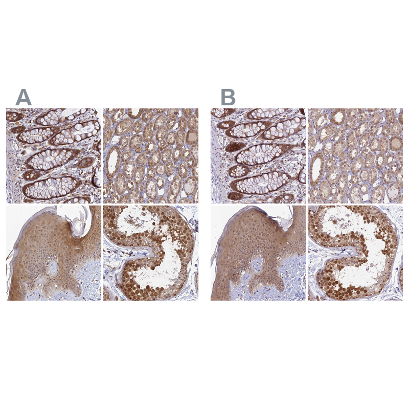 Atlas Antibodies Anti-WDR61 Antibody