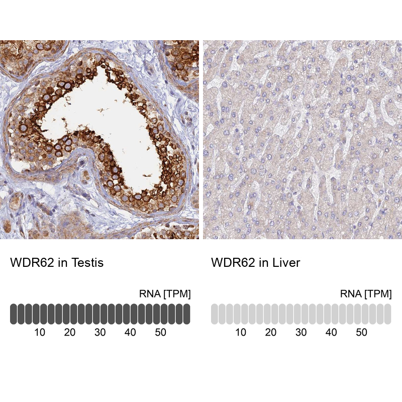 Atlas Antibodies Anti-WDR62 Antibody