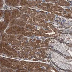 Atlas Antibodies Anti-WDR66 Antibody