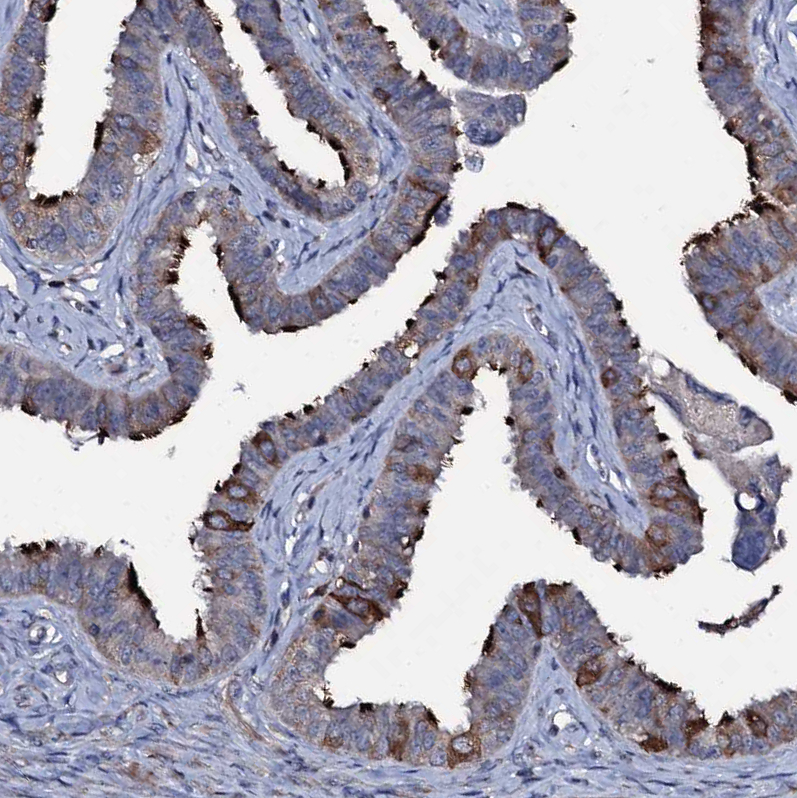 Atlas Antibodies Anti-WDR66 Antibody