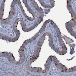 Atlas Antibodies Anti-WDR66 Antibody