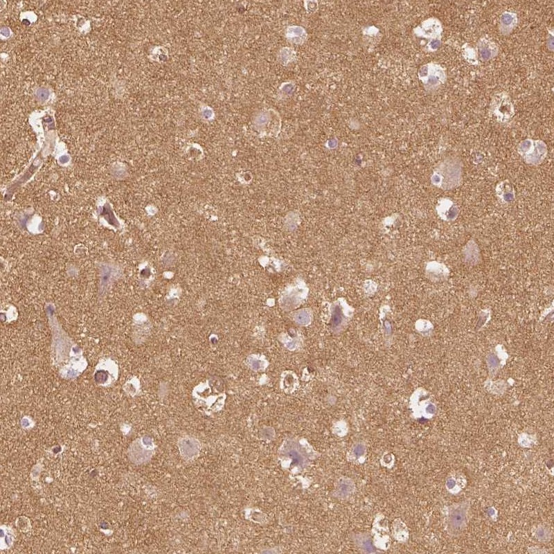 Atlas Antibodies Anti-WDR7 Antibody
