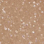 Atlas Antibodies Anti-WDR7 Antibody