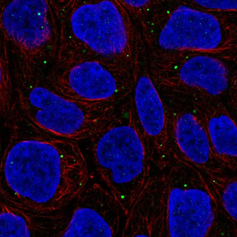 Atlas Antibodies Anti-WDR72 Antibody