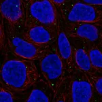Atlas Antibodies Anti-WDR72 Antibody