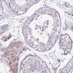 Atlas Antibodies Anti-WDR70 Antibody