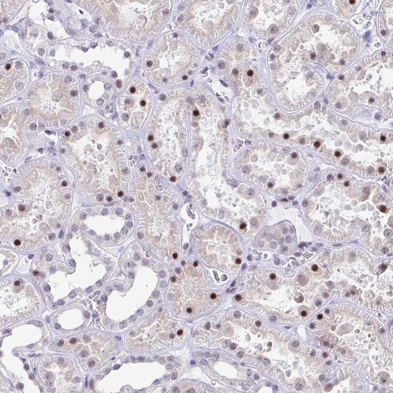Atlas Antibodies Anti-WDR72 Antibody