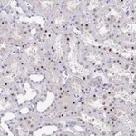 Atlas Antibodies Anti-WDR72 Antibody