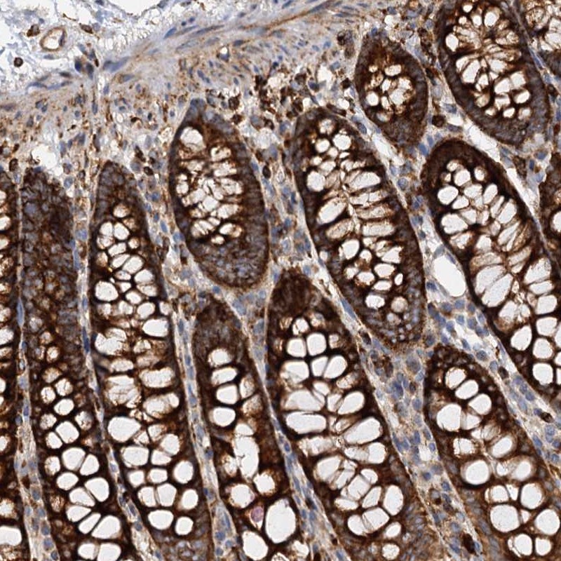 Atlas Antibodies Anti-WDR73 Antibody