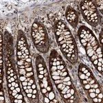 Atlas Antibodies Anti-WDR73 Antibody