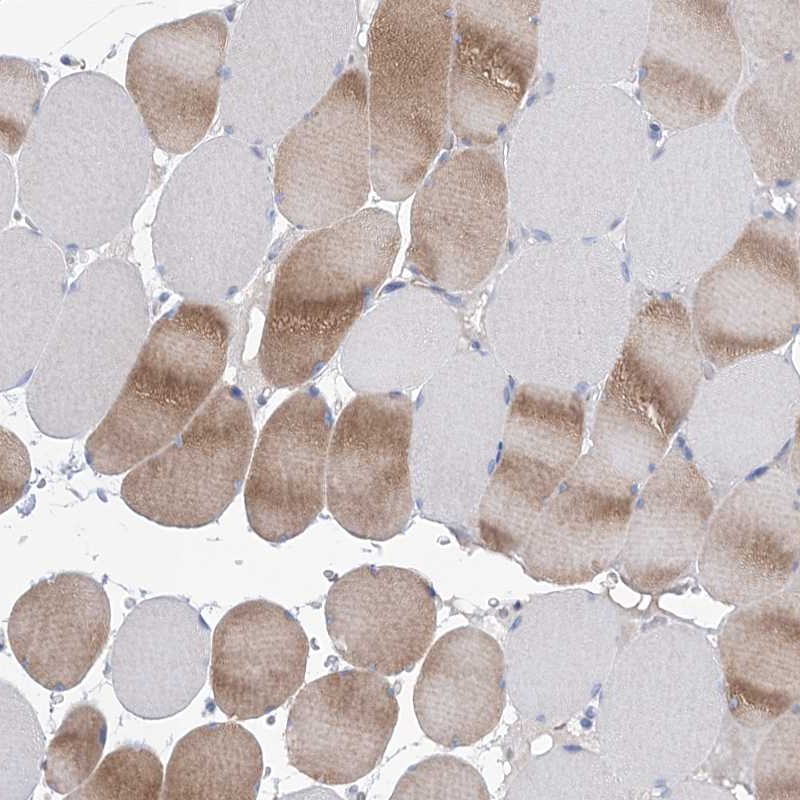Atlas Antibodies Anti-WDR74 Antibody