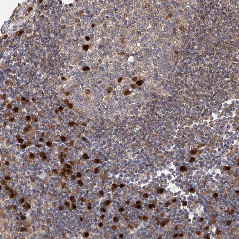 Atlas Antibodies Anti-WDR75 Antibody