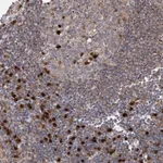 Atlas Antibodies Anti-WDR75 Antibody