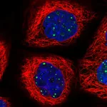 Atlas Antibodies Anti-WDR76 Antibody