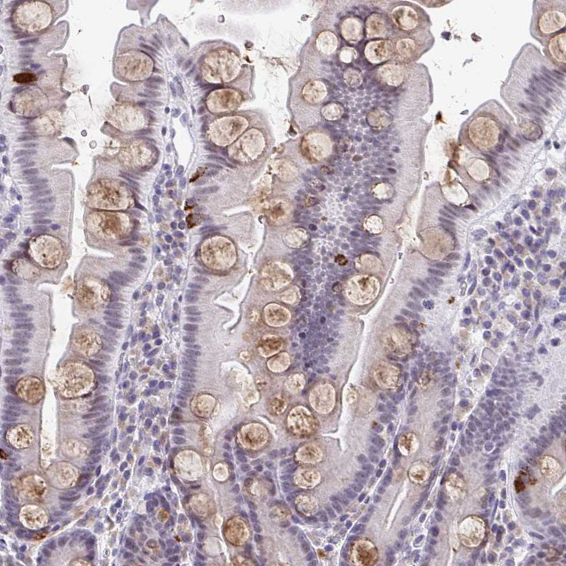 Atlas Antibodies Anti-WDR72 Antibody
