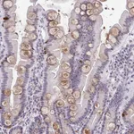Atlas Antibodies Anti-WDR72 Antibody