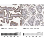 Atlas Antibodies Anti-WDR77 Antibody