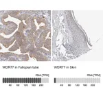 Atlas Antibodies Anti-WDR77 Antibody