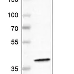 Atlas Antibodies Anti-WDR82 Antibody
