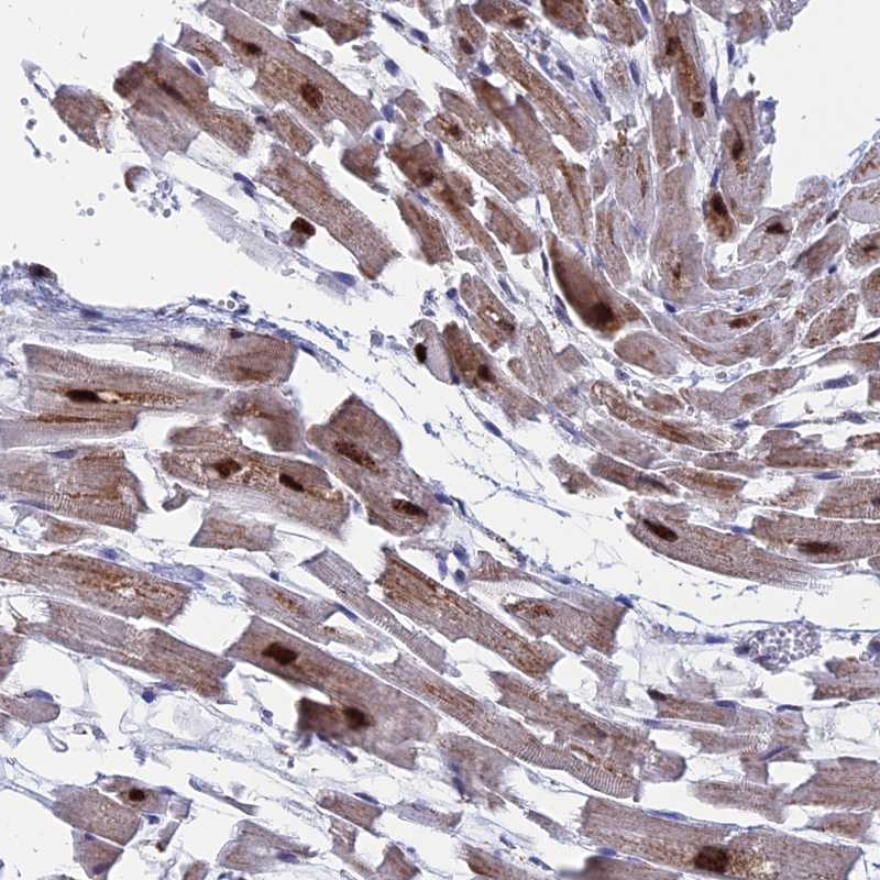 Atlas Antibodies Anti-WDR83 Antibody