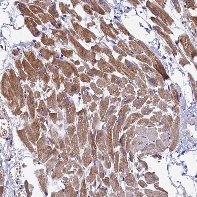 Atlas Antibodies Anti-WDR83 Antibody
