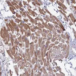 Atlas Antibodies Anti-WDR83 Antibody
